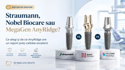 Implanturi dentare: Straumann, Nobel Biocare sau MegaGen AnyRidge? Ce alegi și de ce MegaGen AnyRidge ni se pare cea mai bună opțiune ca raport preț-calitate