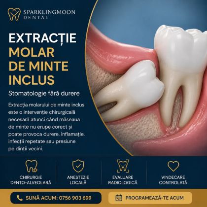 Extracție molar de minte inclus, ilustrație medicală cu măsea de minte blocată în os și gingie, serviciu de chirurgie dento-alveolară la Sparklingmoon Dental Sector 4